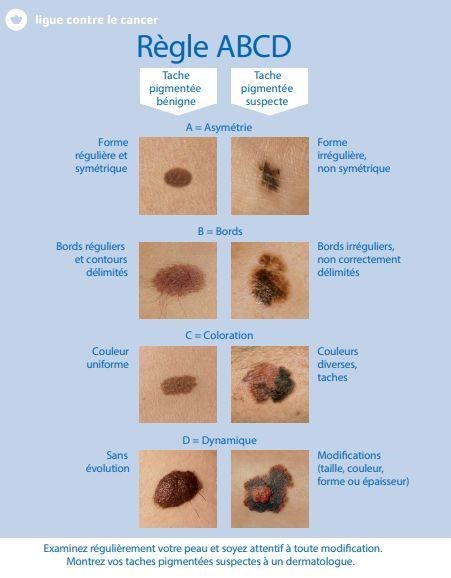 grille de prévention du cancer de la peau